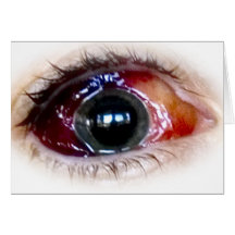 Blood shot greeting card