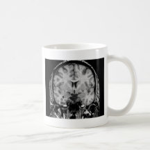 Brain MRI, coronal slice Coffee Mug