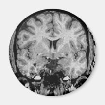 Brain MRI, coronal slice Fridge Magnet