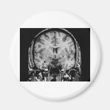 Brain MRI, coronal slice Fridge Magnet