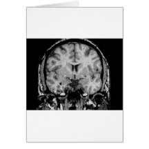 Brain MRI, coronal slice Greeting Card