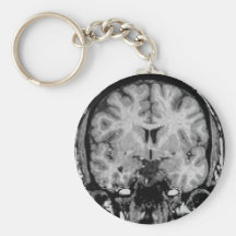 Brain MRI, coronal slice Key Chain