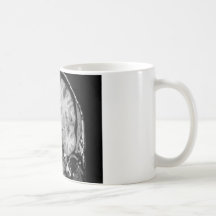 Brain MRI, coronal slice Mug