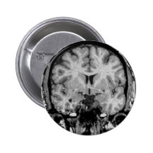 Brain MRI, coronal slice Pinback Button
