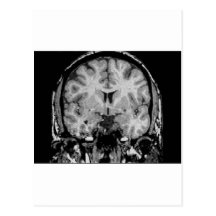 Brain MRI, coronal slice Post Card