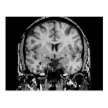 Brain MRI, coronal slice Postcard
