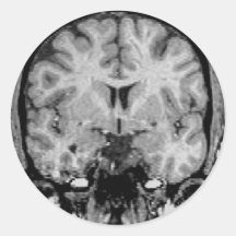 Brain MRI, coronal slice Stickers