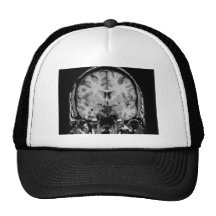 Brain MRI, coronal slice Trucker Hats