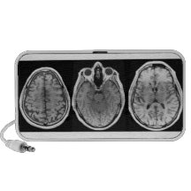 Brainophonic PC Speakers