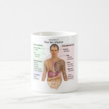 Chart of the Symptoms of Raw Fish Infection Mug