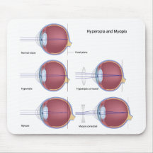 Common Eye defects Mousepad