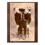 Conjoined Twins Vintage Cards and Postcards