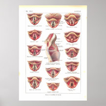 Diseases of Larynx Anatomy Poster French
