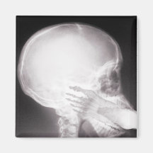 Foot in Mouth X-Ray Fridge Magnet
