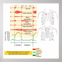 Graphically Recording of Heartbeat Sounds Diagram Print