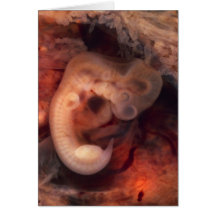 Human Embryo 7th Week of Pregnancy 5th Peek P.O. Greeting Cards