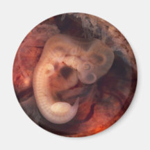 Human Embryo 7th Week of Pregnancy 5th Peek P.O. Fridge Magnets