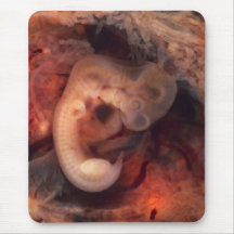 Human Embryo 7th Week of Pregnancy 5th Peek P.O. Mousepads