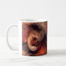 Human Embryo 7th Week of Pregnancy 5th Peek P.O. Mug
