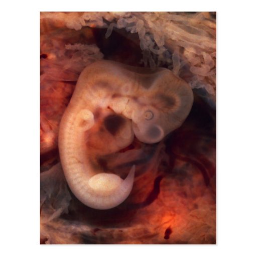 Human Embryo 7th Week of Pregnancy 5th Peek P.O. Postcard