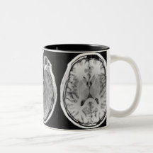 MRI brain image mug