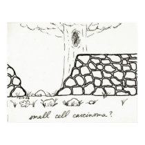 Small Cell Carcinoma print posters