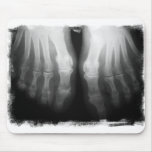 X-Ray Feet Human Skeleton Bones Black & White Mousepad