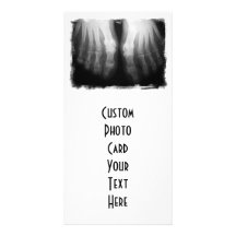 X-Ray Feet Human Skeleton Bones Black & White Custom Photo Card
