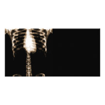 X-RAY SKELETON TORSO RIBS - SEPIA CUSTOMIZED PHOTO CARD
