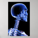 Search for x ray bones posters Image