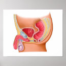 Search for penis gifts Urinary tract