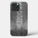 Search for xray electronics Doctor