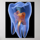 Search for molar posters Digitally generated image