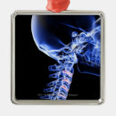 Search for x ray christmas tree decorations Image