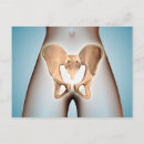 Search for pelvic Anatomy