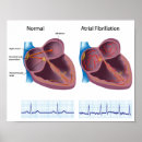 Search for heart attack posters Cardiology