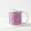 Search for lung mugs Cancer