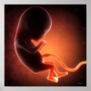 Search for foetus posters Medical
