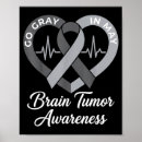 Search for brain tumour art Alzheimerâ