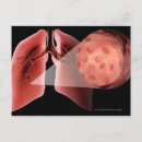 Search for lung postcards Body