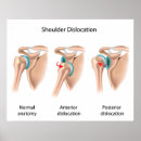 Search for dislocation Orthopaedics