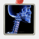 Search for x ray christmas tree decorations Small business