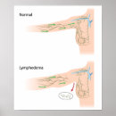 Search for diagram posters System