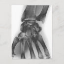 Search for normal photography X ray image