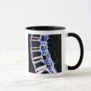 Search for vertebra mugs Medical