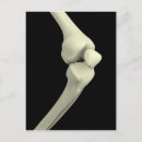 Search for knee postcards Joint