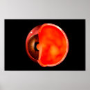 Search for ophthalmology posters Eyes