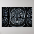 Search for radiology art Scan