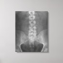 Search for orthopaedics art Chiropractic