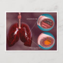 Search for infections postcards Magnification
